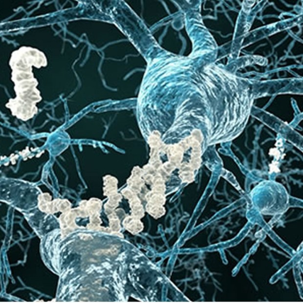 Link between gum disease and cognitive decline in Alzheimer’s